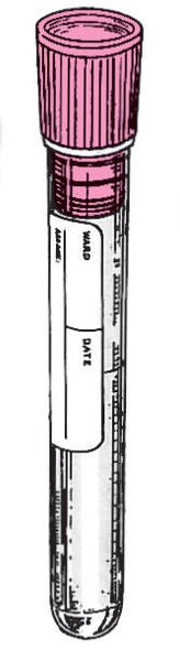 Imagen de Paquete de 100 Tubos de 0.3ml Citrato de Sodio 3ml 13x75mm Kima