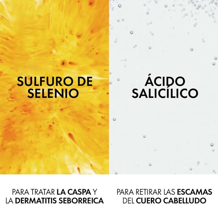 Imagen de Vichy Shampoo Dercos Anticaspa Cabello Grasos 390 ml