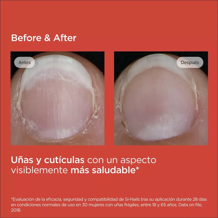 Imagen de Isdin Fortalecedor De Uñas Si Nails Varnish 2.5 Ml